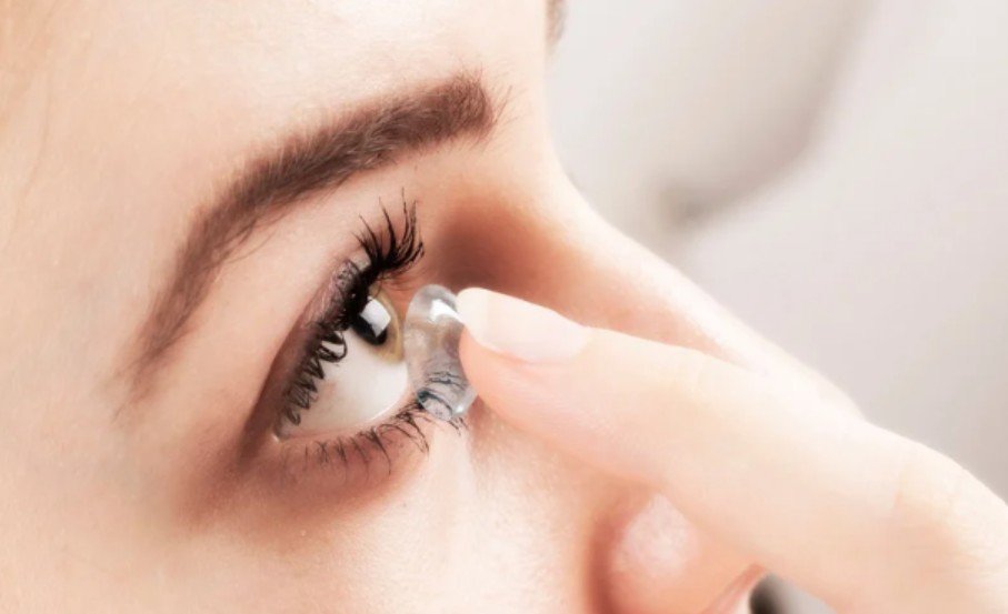 Monthly Versus Daily Contacts for Dry Eyes